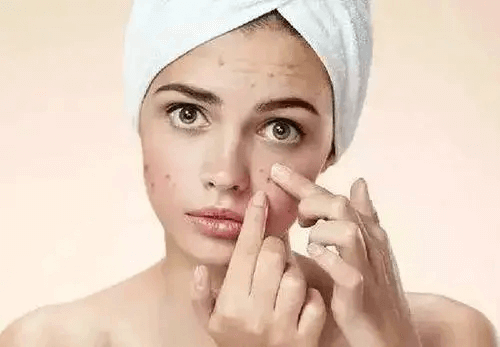 How To Remove Pimples Overnight
